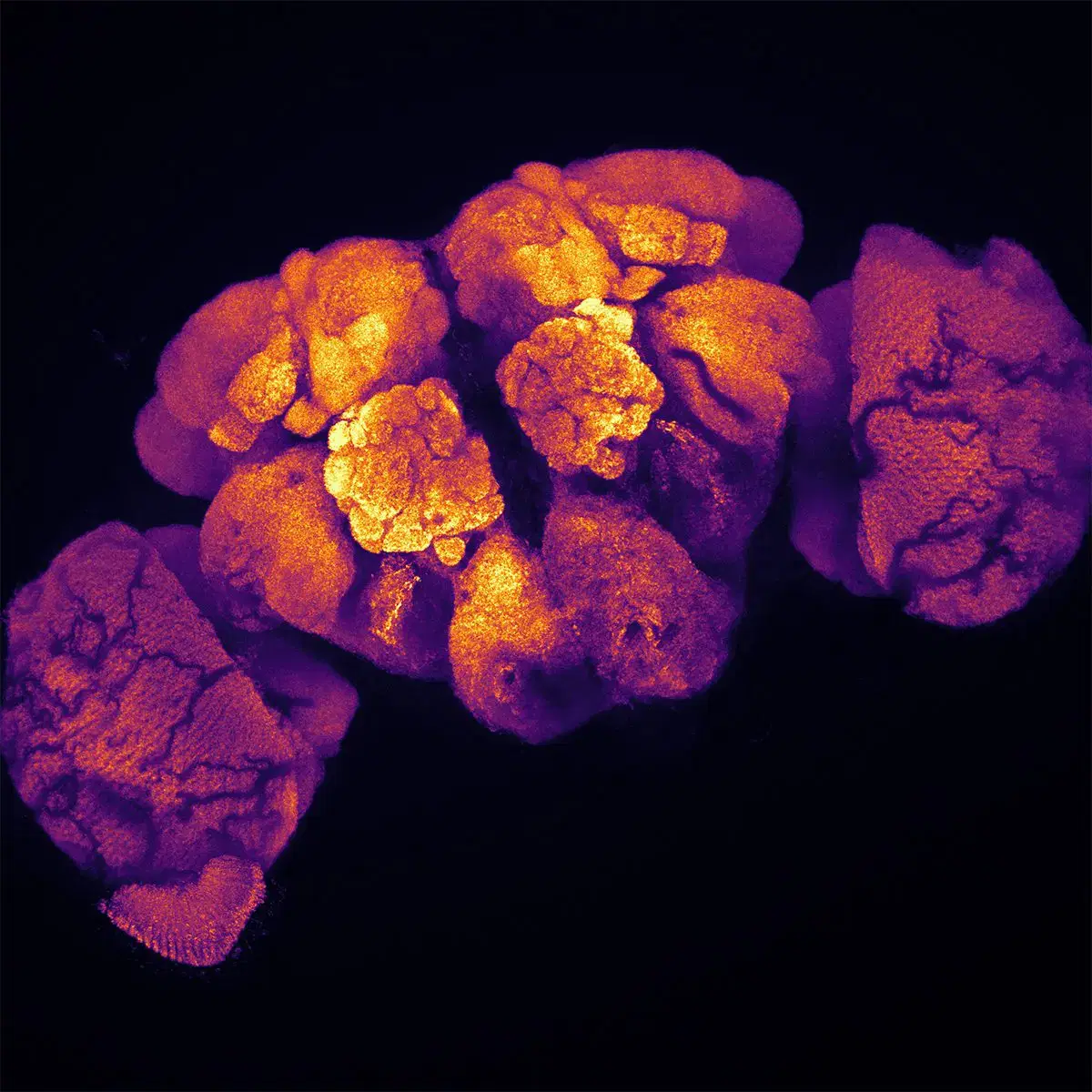 Fluorescent microscope image of a biological tissue cluster, glowing in yellow and orange hues against a dark background, showing textured, irregular shapes and detailed cellular structures.