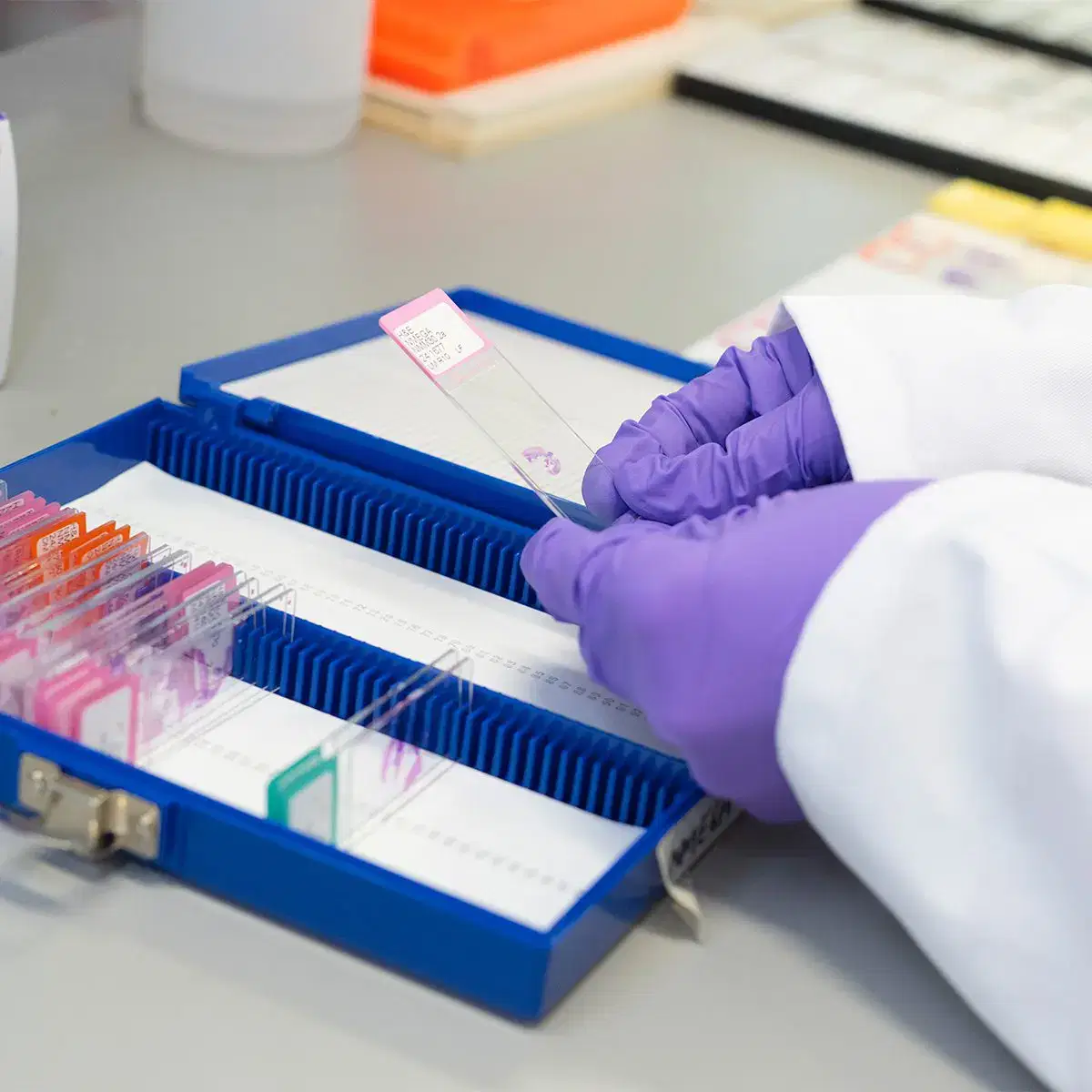 A person wearing purple gloves handles glass microscope slides with tissue samples in a blue storage case on a laboratory bench.